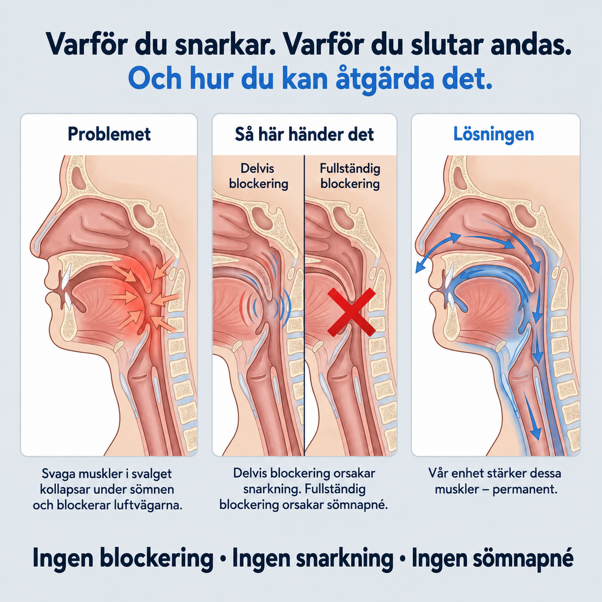 Smart antisnarkningsenhet